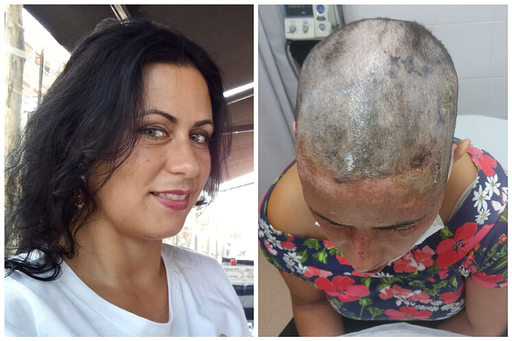 Ana Maria, avant et après