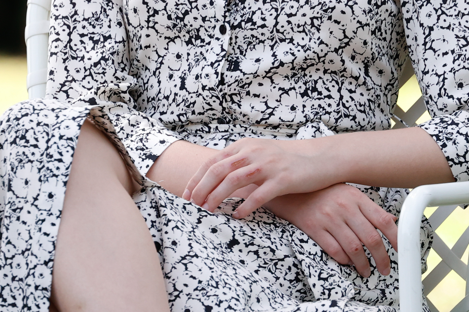 La princesse Leonor, avec des brûlures à la main gauche.